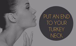 How To Put An End To Your Neck Folds & Wrinkles With A Neck Lift