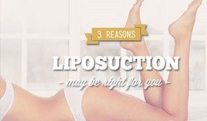 3 Reasons Why Liposuction Might Be Right for You