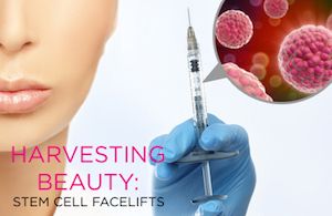 The Debate Around Stem-Cell Facelifts