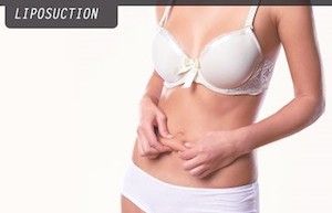 Lose the Bulges for Good with VASER Liposuction